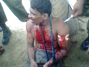 2009_SriLanka_Victim.jpg