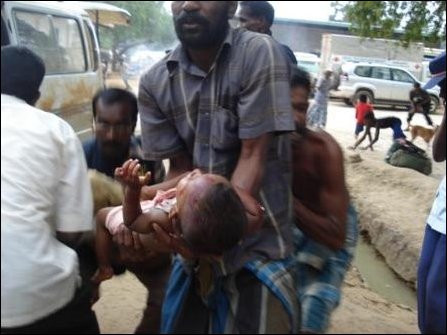 Safe Zone Vanni A wounded child is being brought to the hospital. Note the persons in picture benting down as shell explodes near the hospital Photo: TamilNet March 3 2009