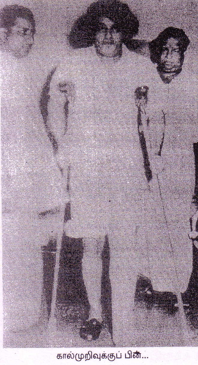 MGR with his left leg in cast (1959)